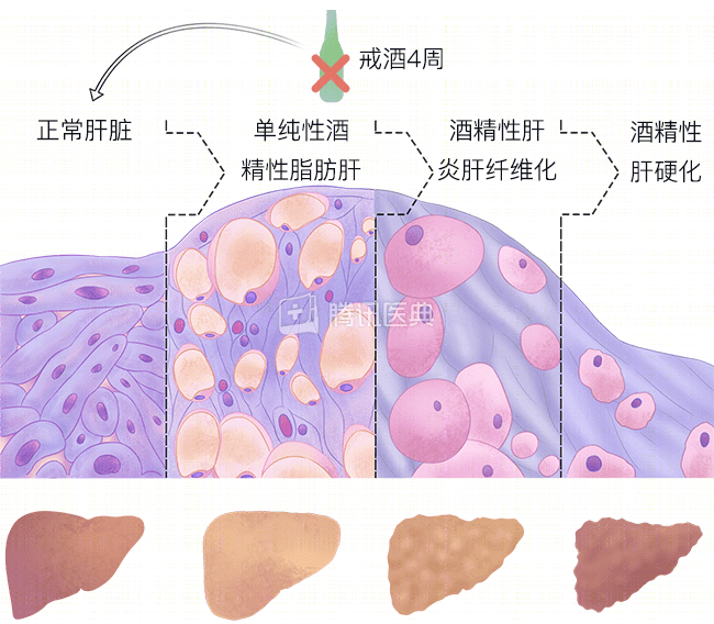ed03e82d2150ffd3e44ca9e4761b46ec.png